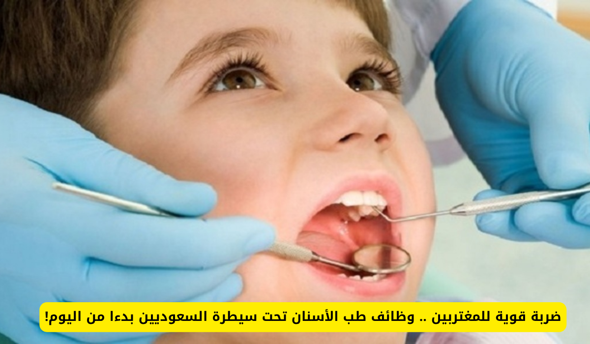 رفع التوطين